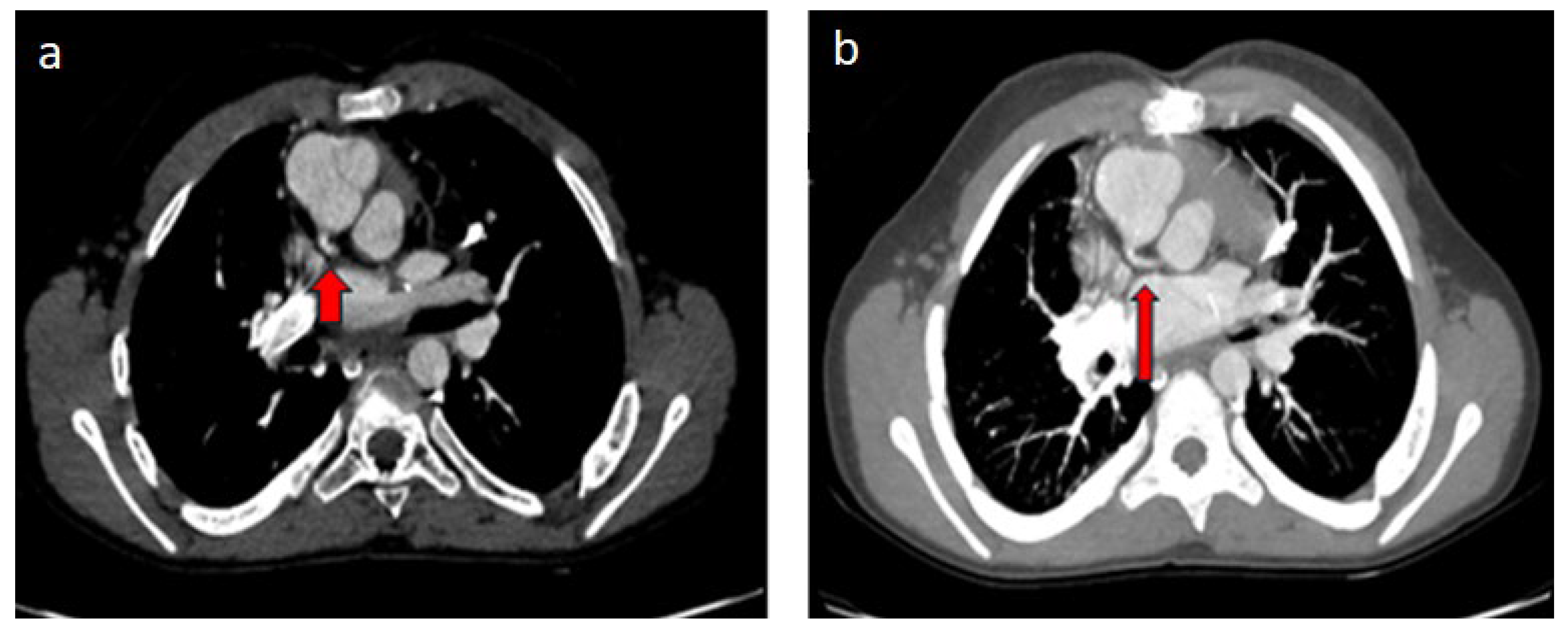 Diagnostics 14 02022 g004