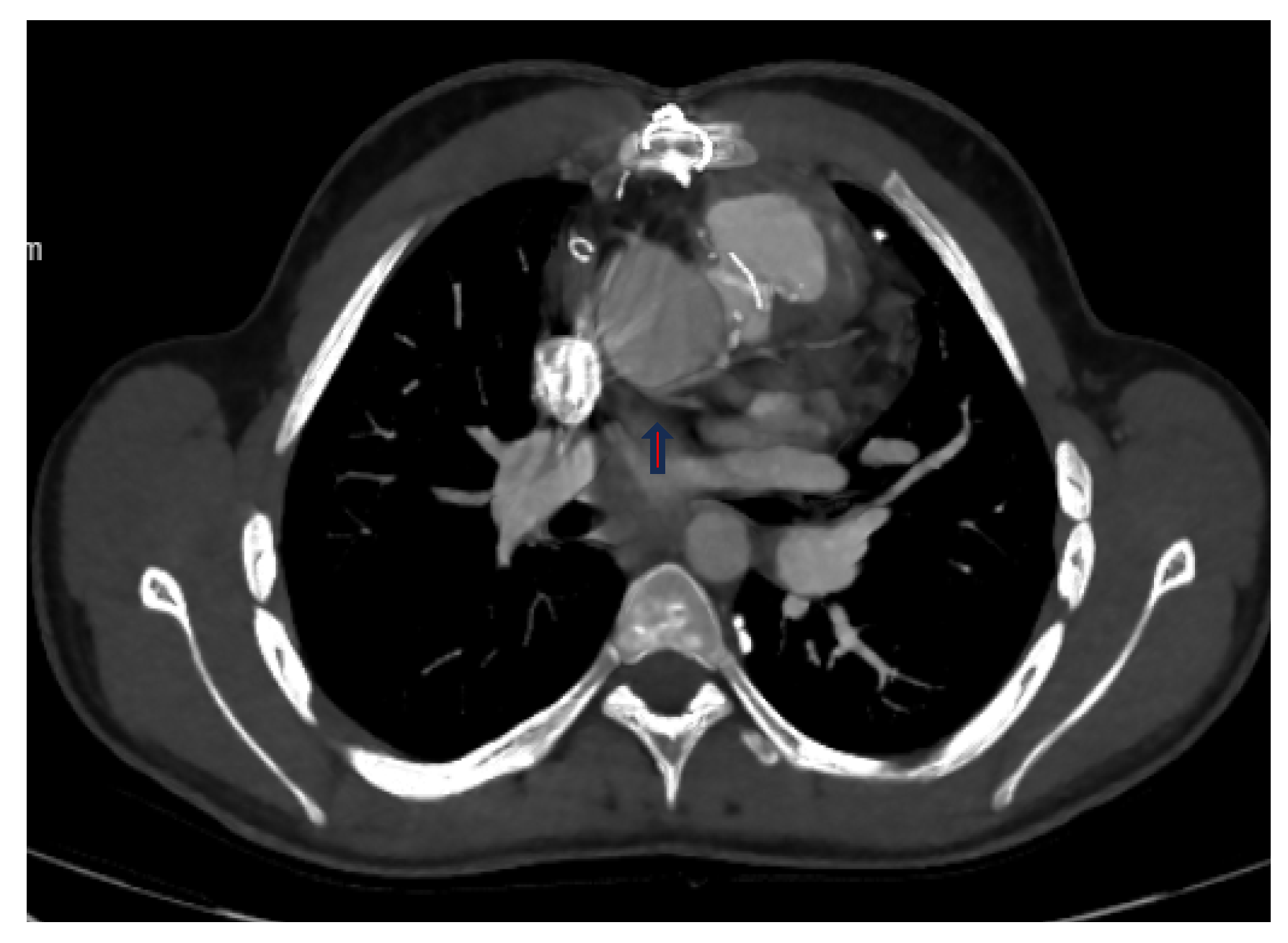 Diagnostics 14 02022 g005