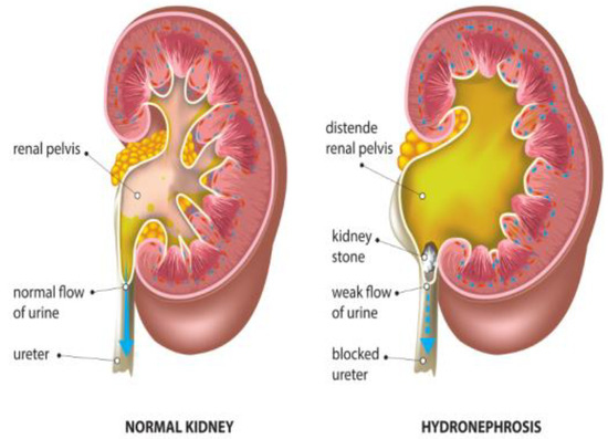 Diagnostics 14 02059 g003
