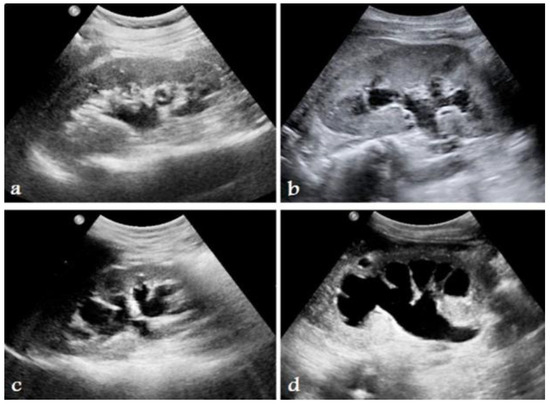 Diagnostics 14 02059 g004