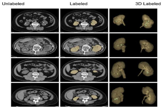 Diagnostics 14 02059 g006