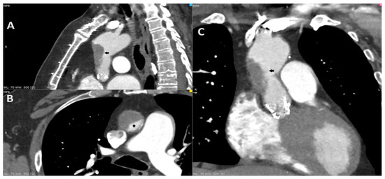 Diagnostics 14 02070 g001