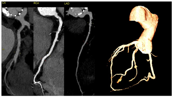 Diagnostics 14 02070 g003