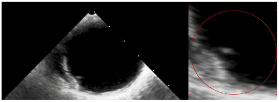 Diagnostics 14 02070 g005