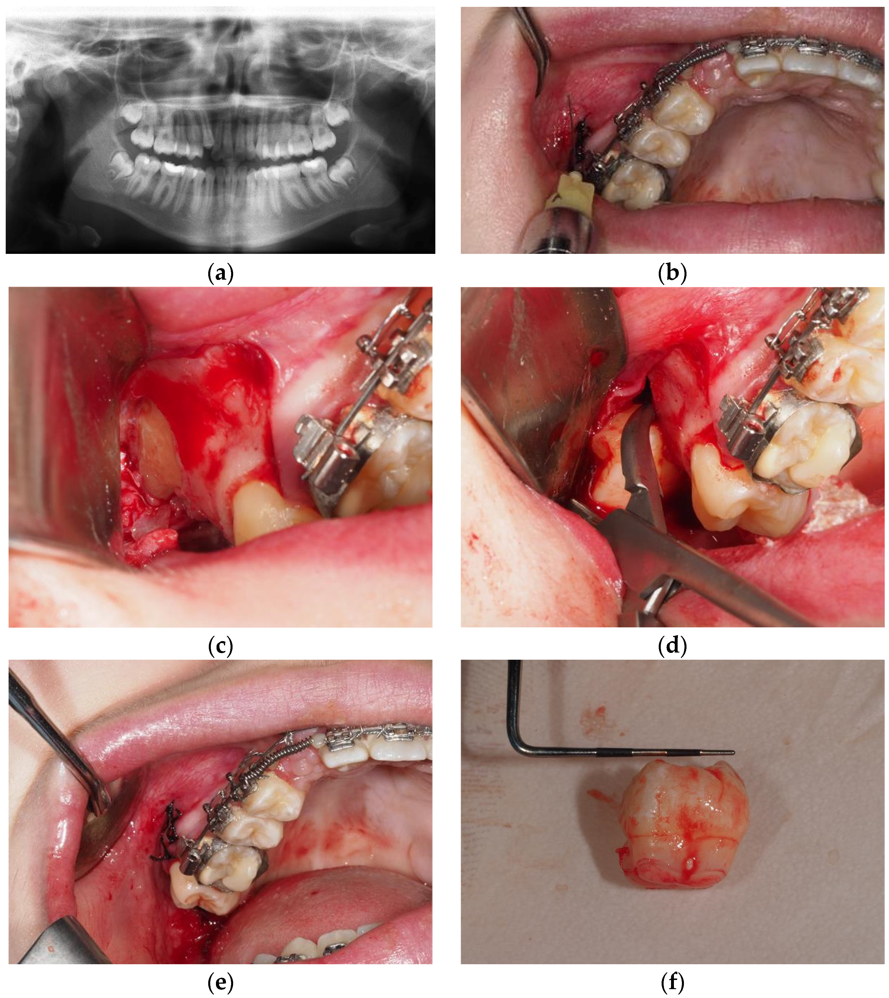 Diagnostics 14 02075 g001