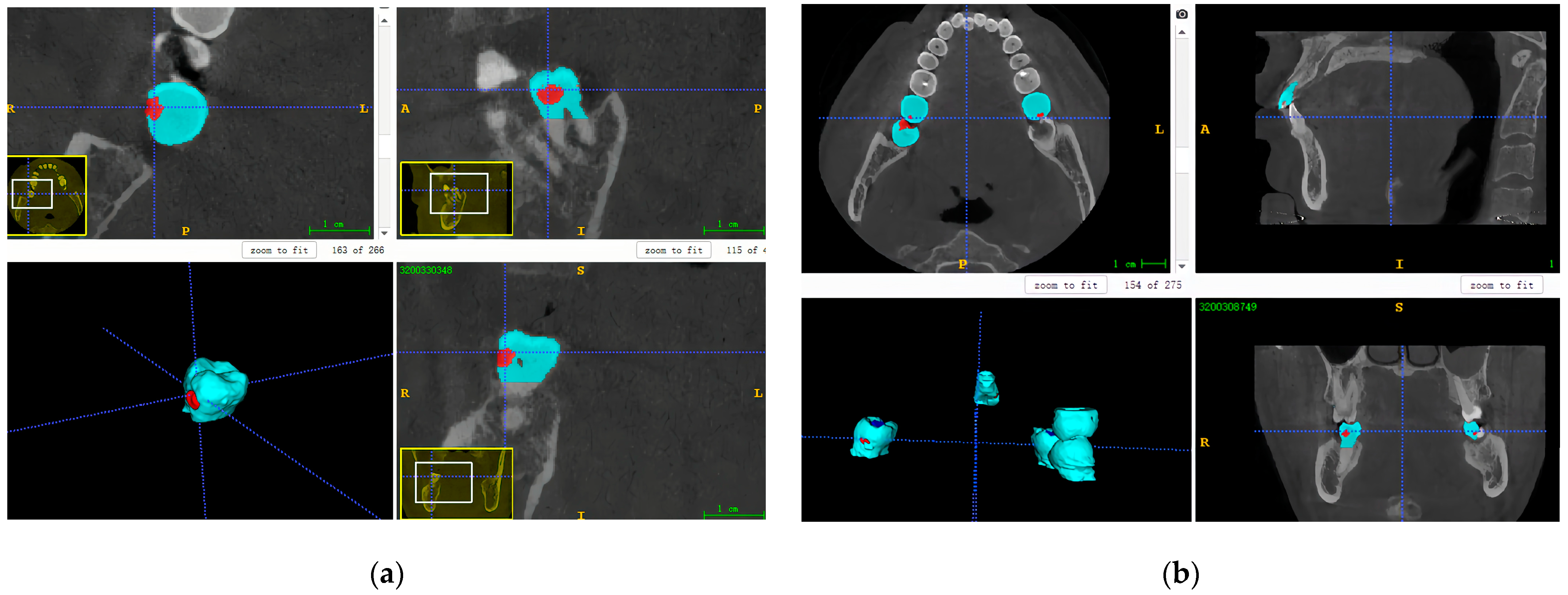 Diagnostics 14 02080 g002