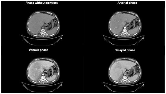 Diagnostics 14 02088 g001