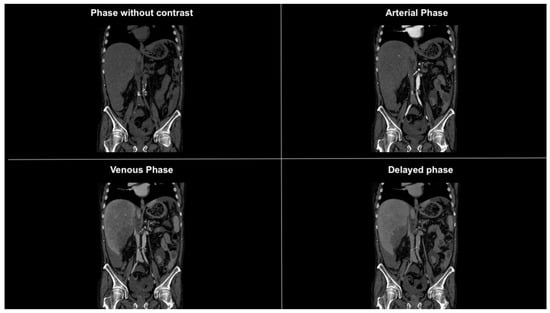 Diagnostics 14 02088 g002