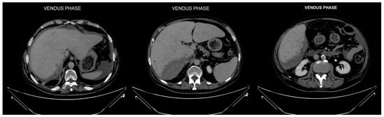 Diagnostics 14 02088 g003
