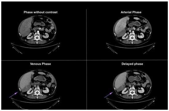 Diagnostics 14 02088 g004