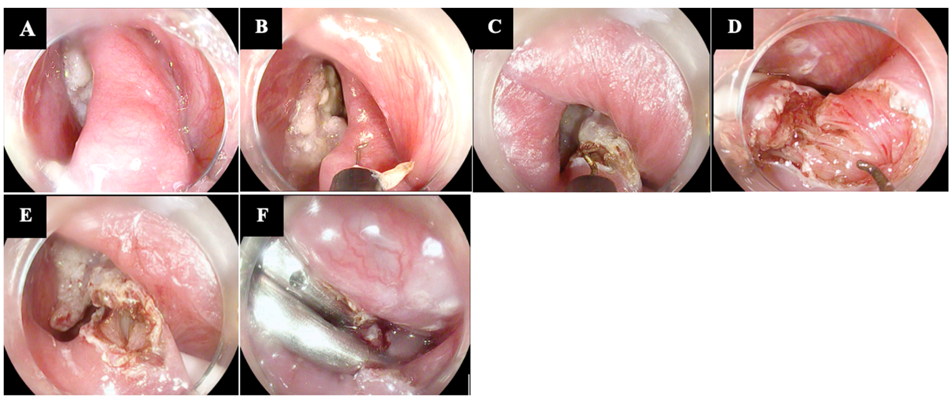 Diagnostics 14 02155 g001