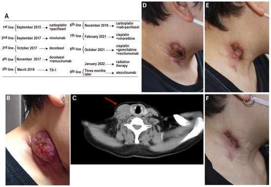 Diagnostics 14 02159 g001