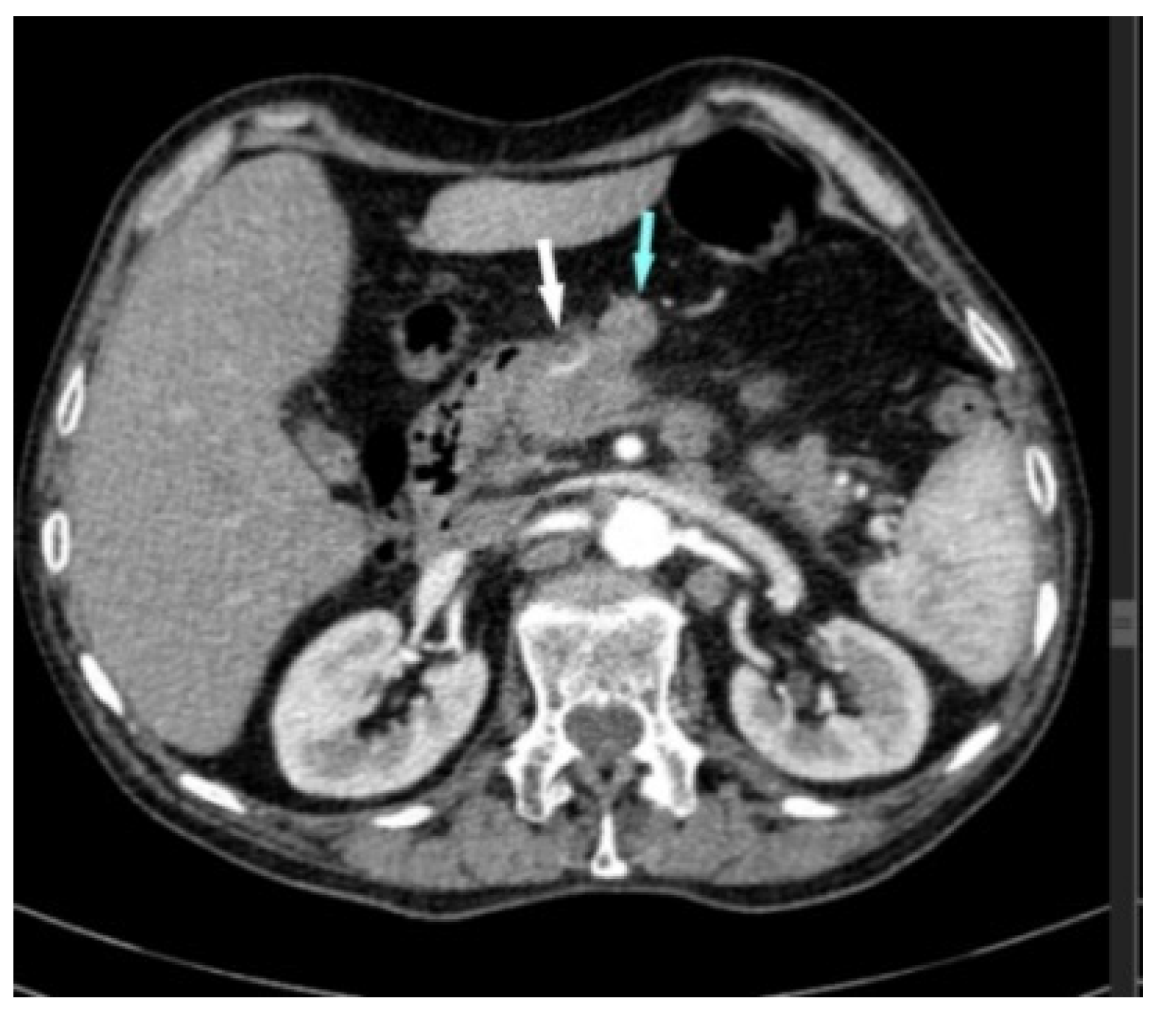 Diagnostics 14 02164 g001