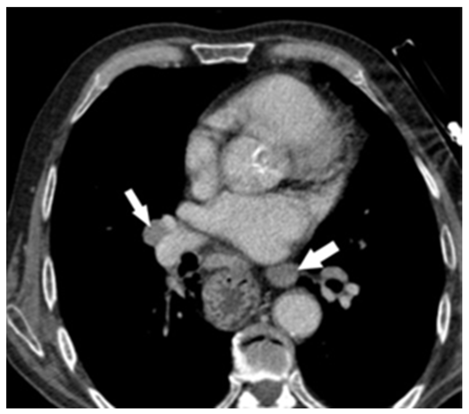 Diagnostics 14 02164 g003