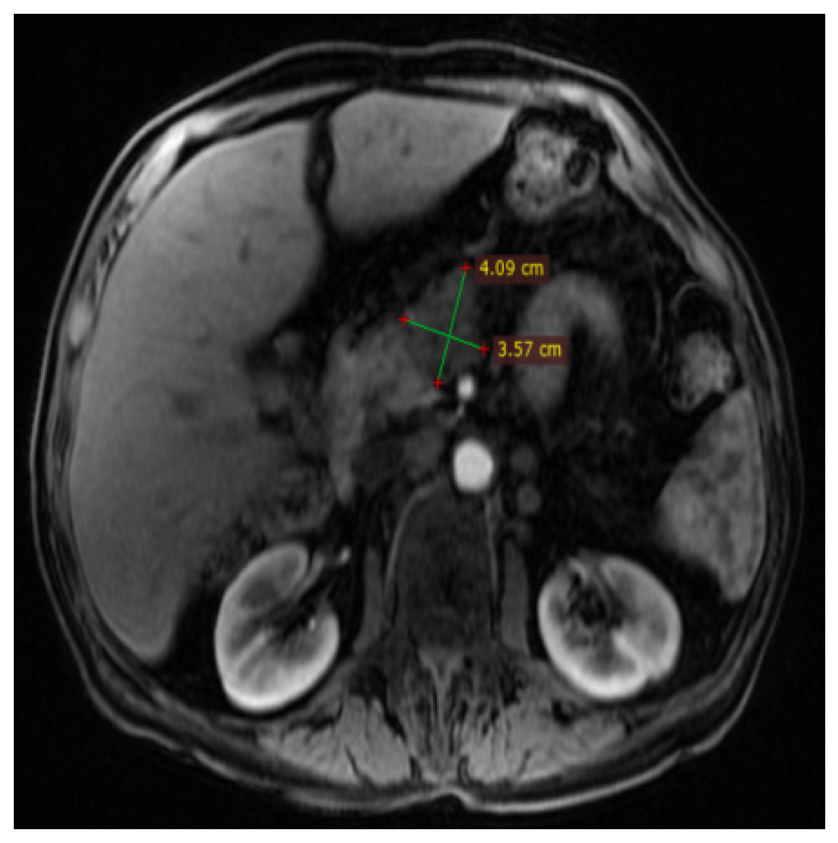 Diagnostics 14 02164 g004