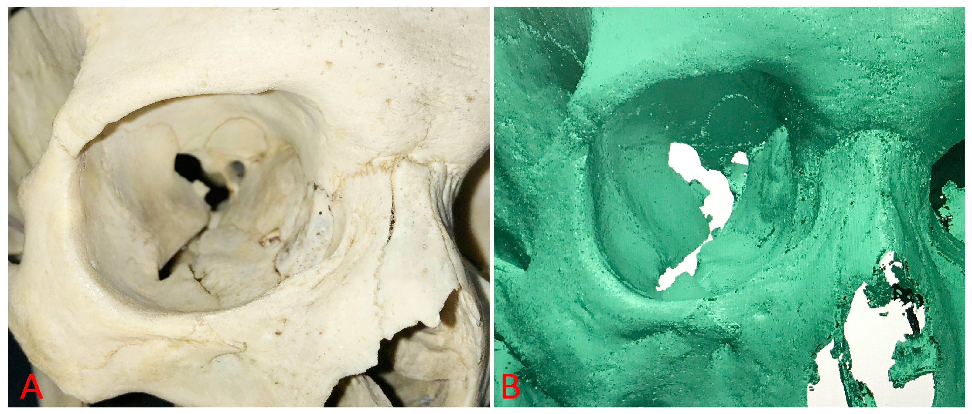 Diagnostics 14 02168 g003 Diagnostics 14 02168 g003