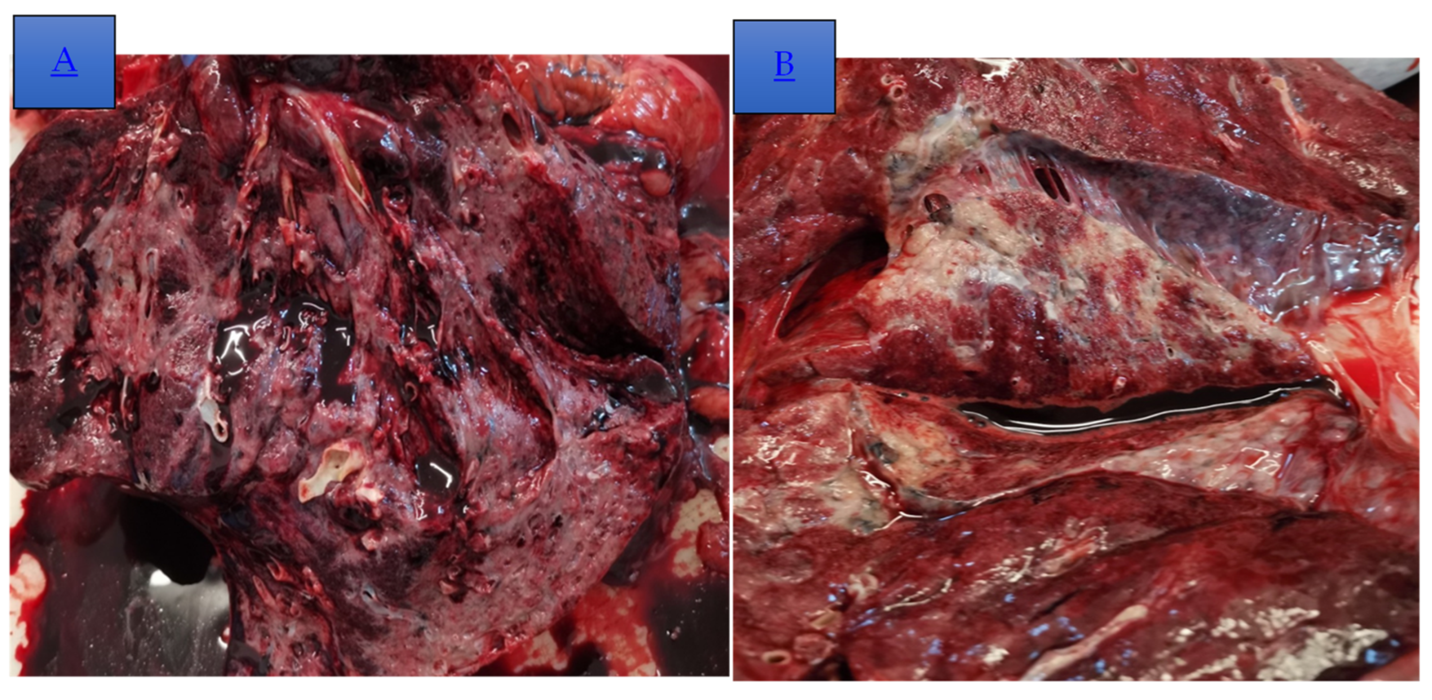 Diagnostics 14 02175 g005