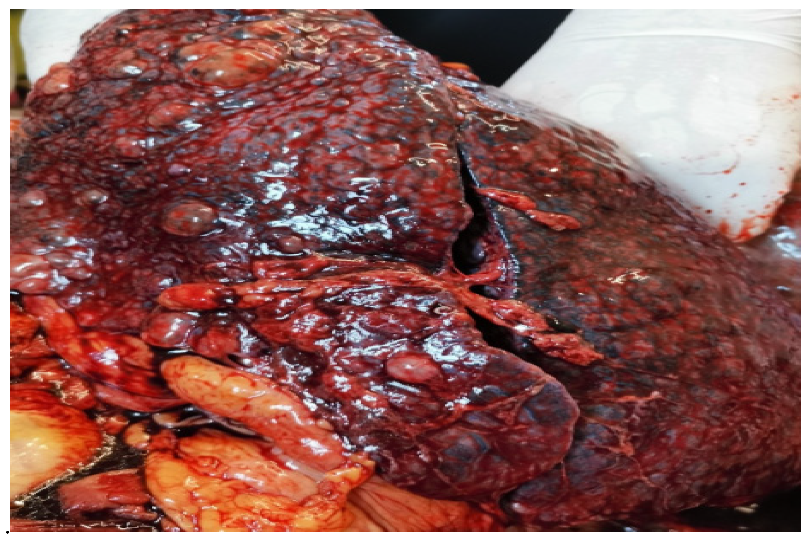 Diagnostics 14 02175 g006