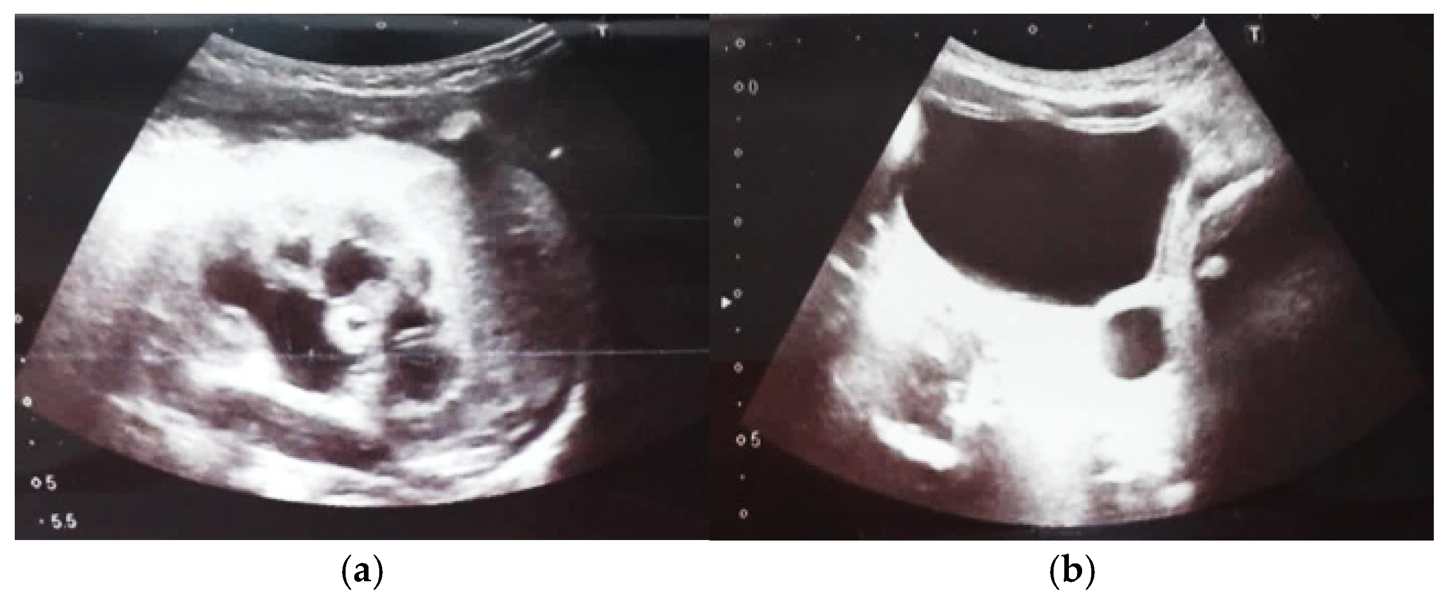 Diagnostics 14 02243 g009