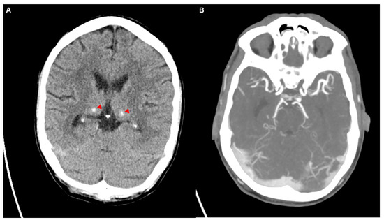 Diagnostics 14 02246 g002