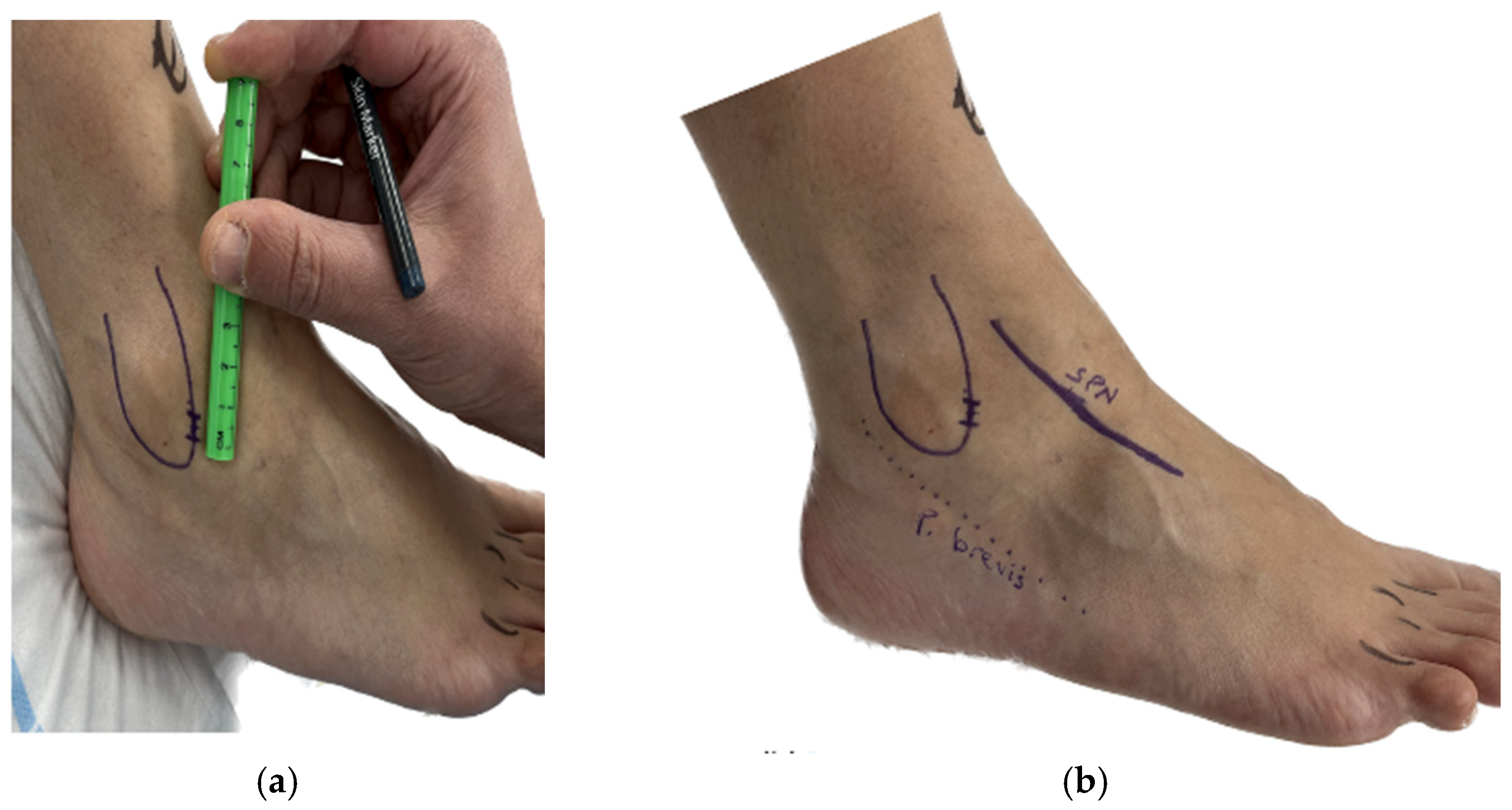Diagnostics 14 02252 g001