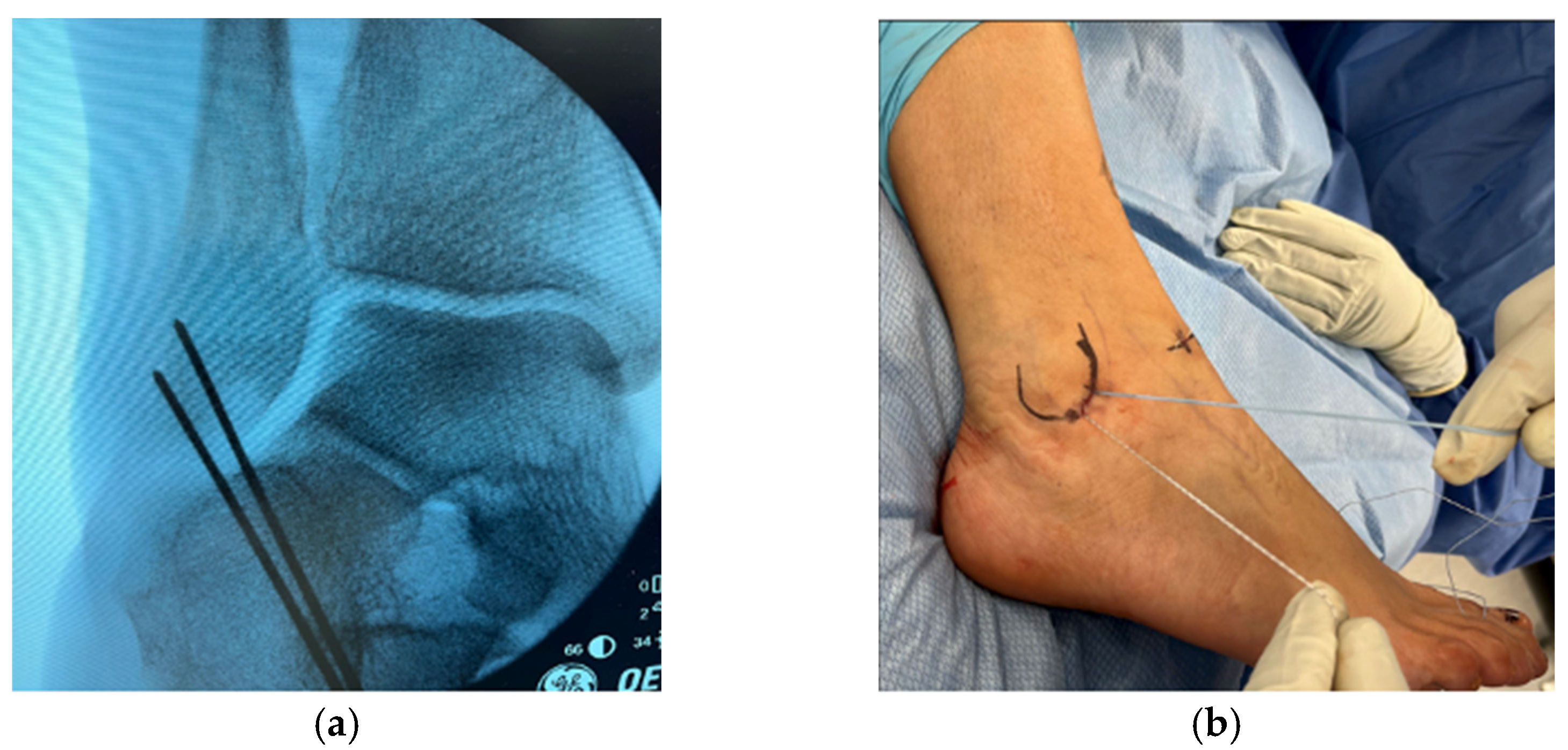 Diagnostics 14 02252 g002