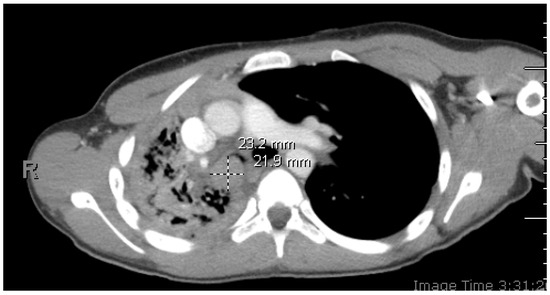 Diagnostics 14 02254 g001