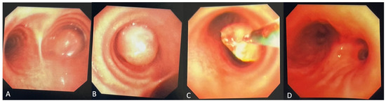 Diagnostics 14 02254 g002