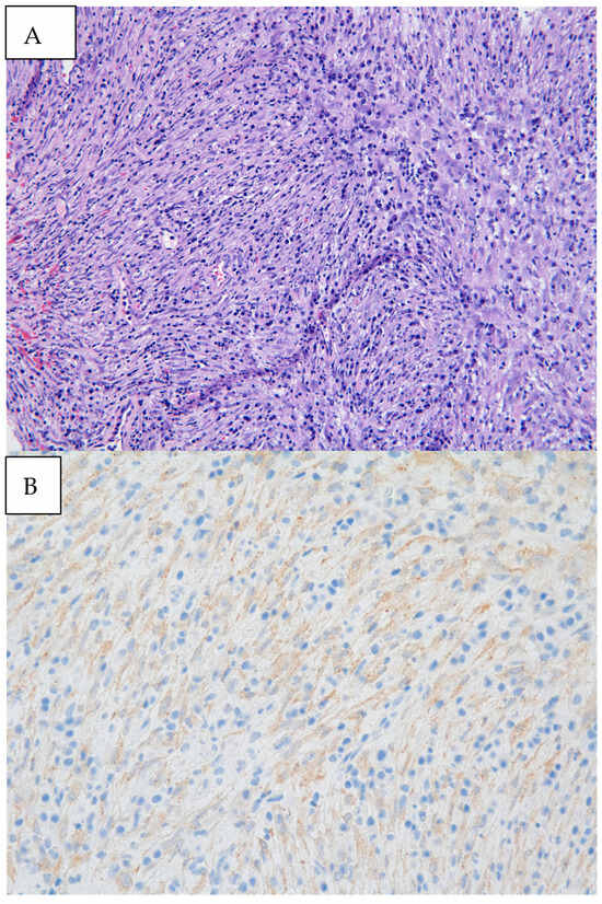 Diagnostics 14 02254 g003
