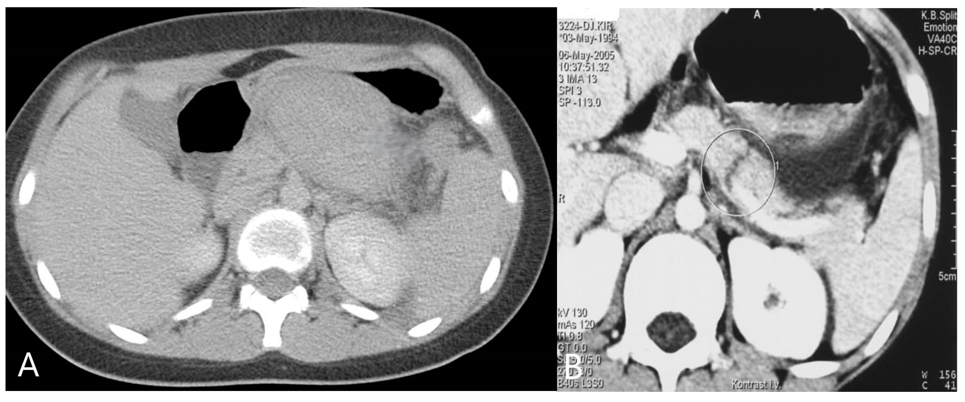 Diagnostics 14 02257 g003