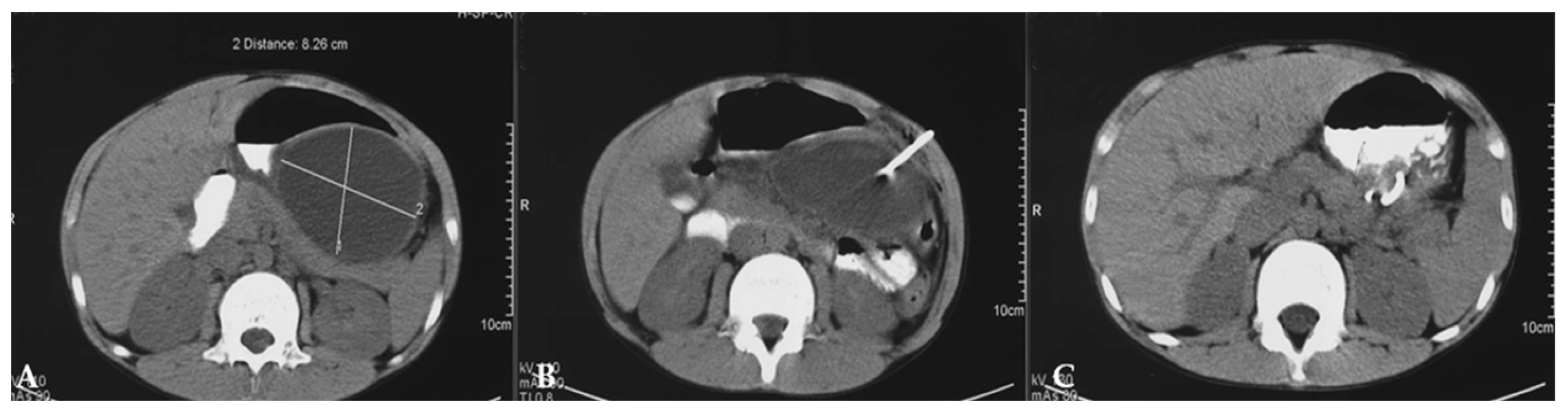 Diagnostics 14 02257 g004