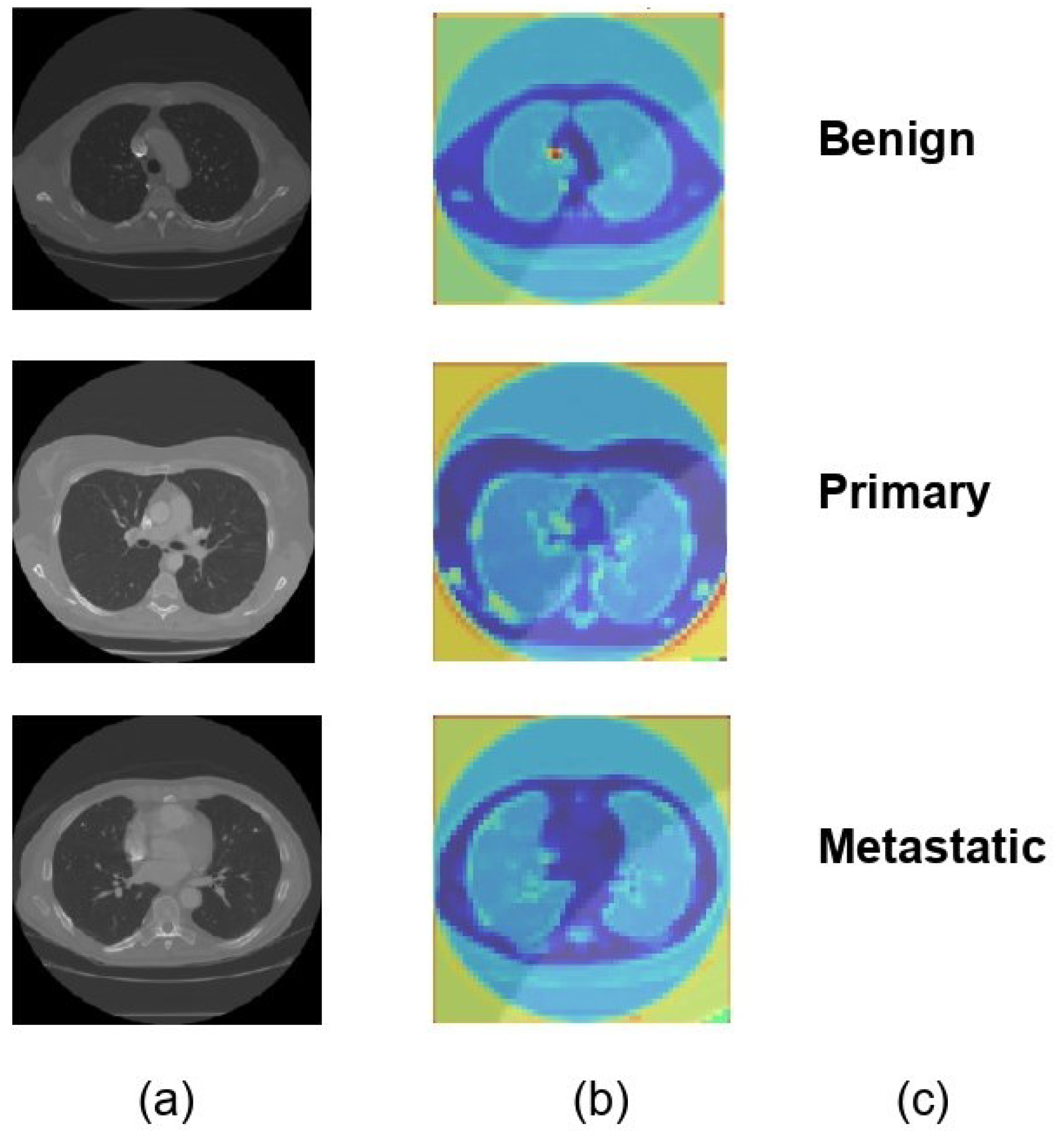 Diagnostics 14 02282 g006