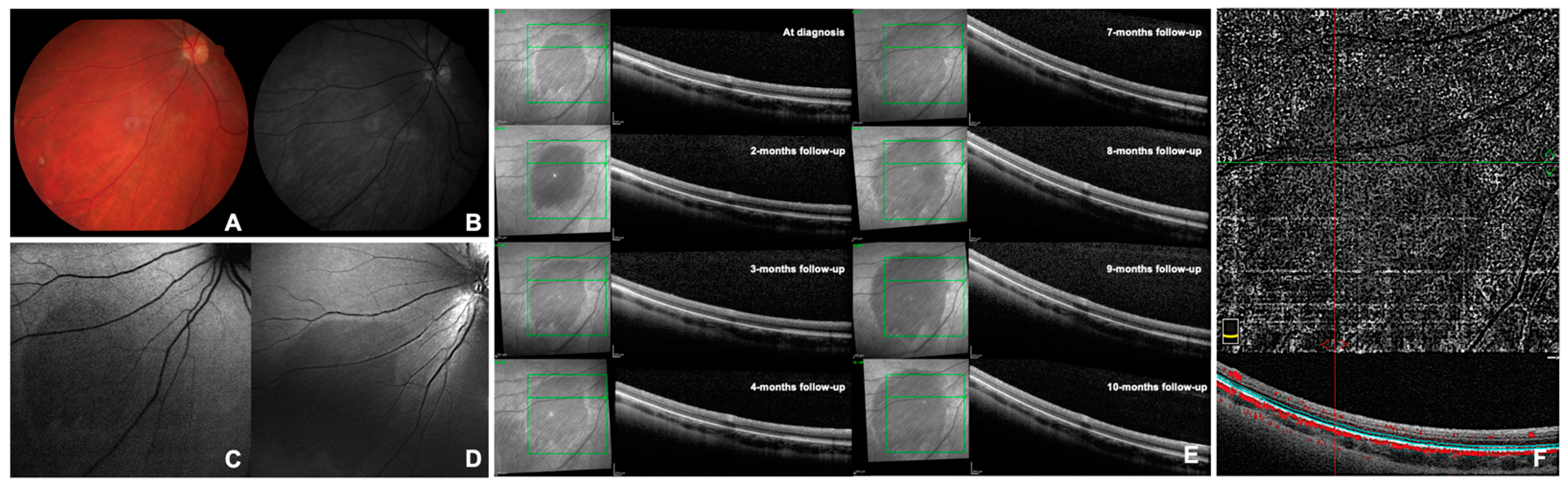 Diagnostics 14 02289 g001