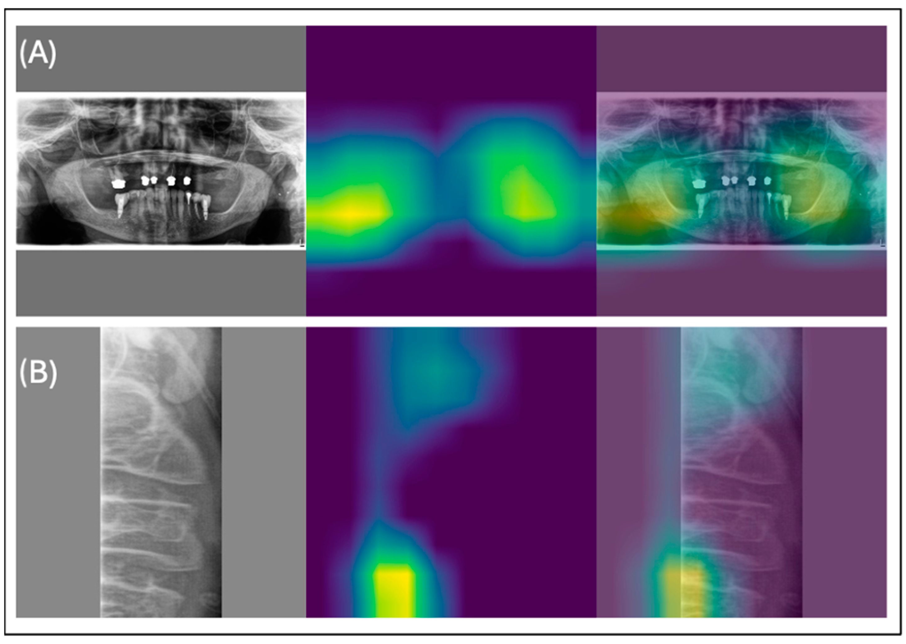 Diagnostics 14 02298 g002 Diagnostics 14 02298 g002