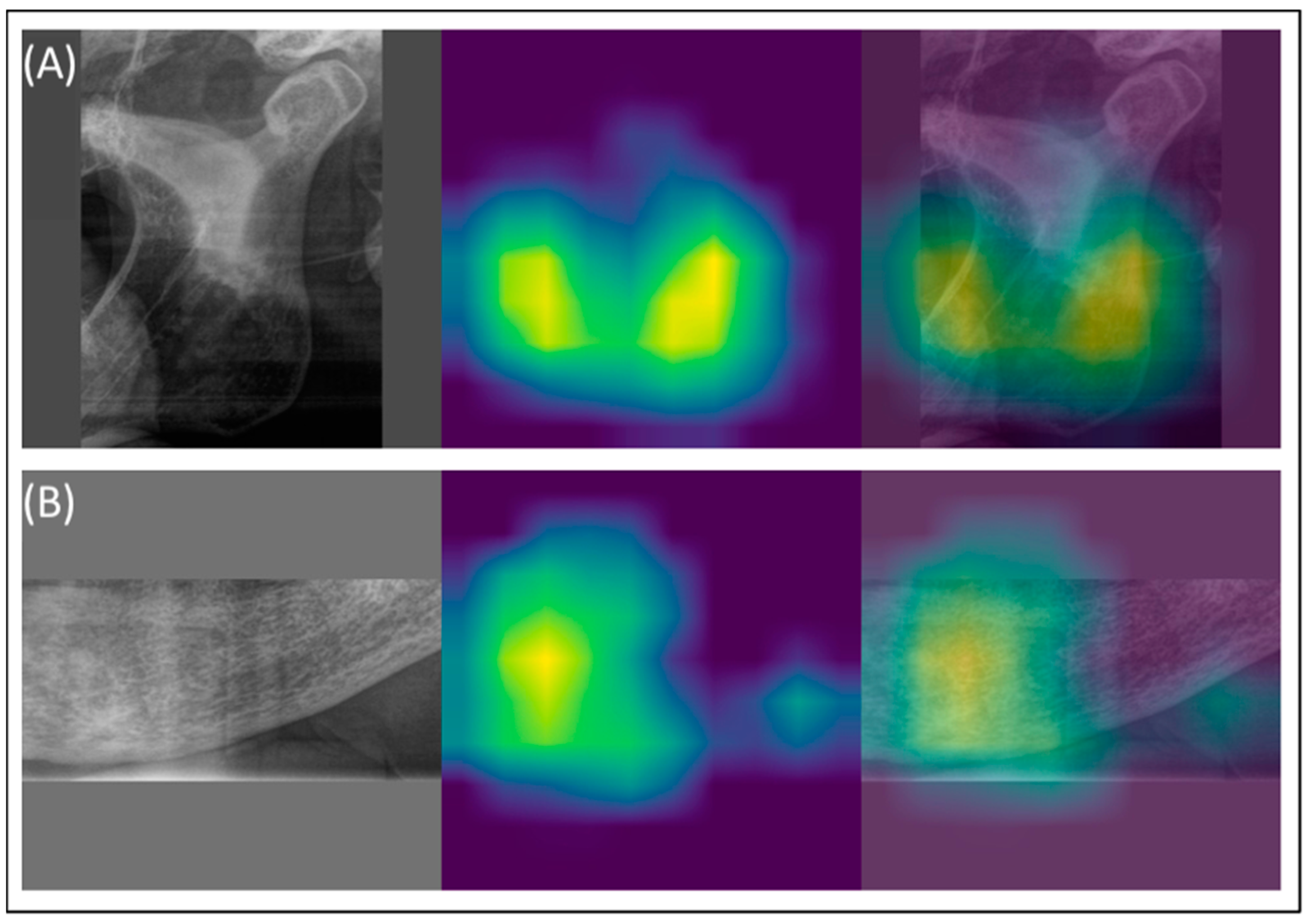 Diagnostics 14 02298 g003 Diagnostics 14 02298 g003