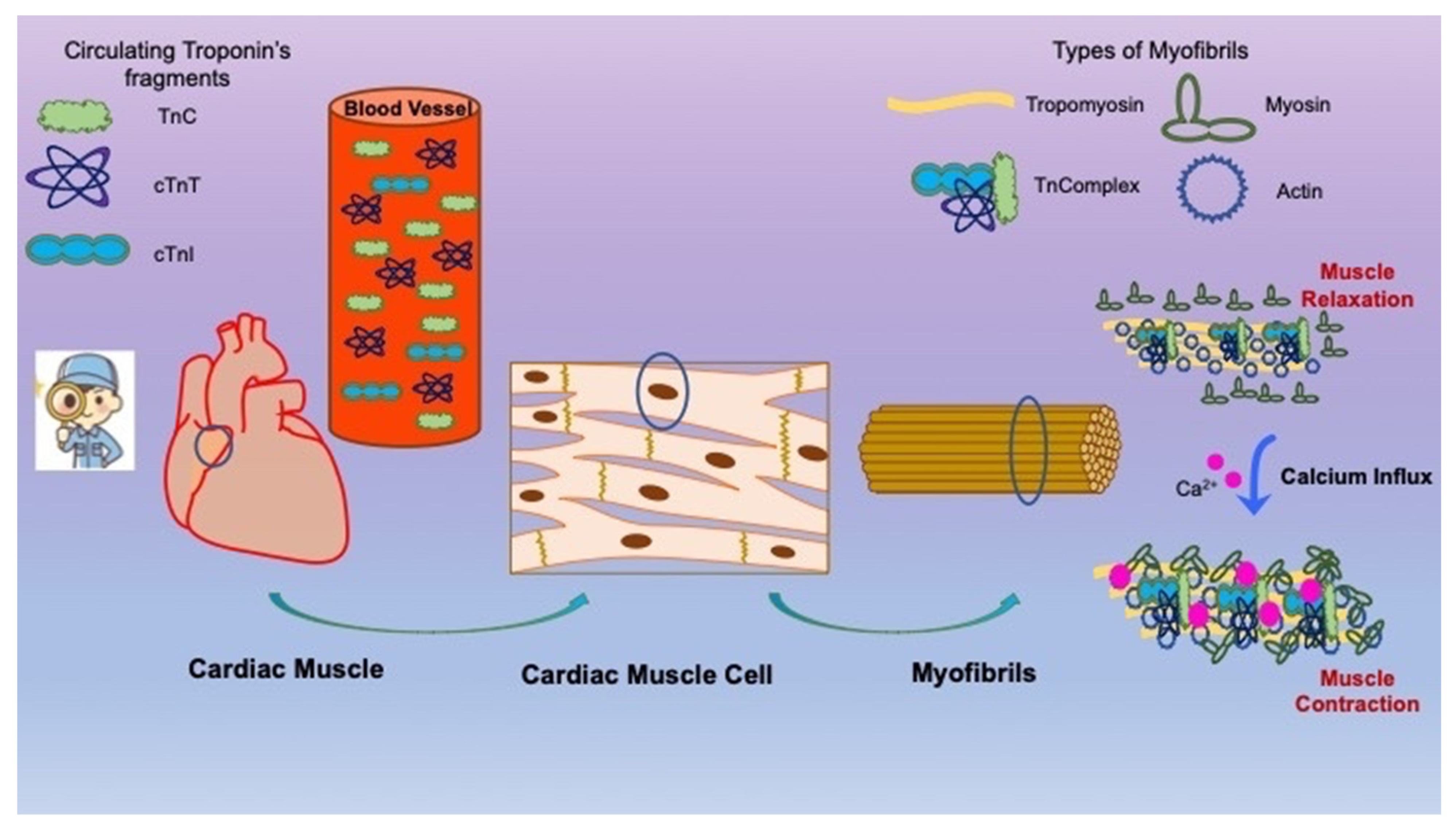 Cardiac Troponin Levels in Patients with Chronic Kidney Disease ...