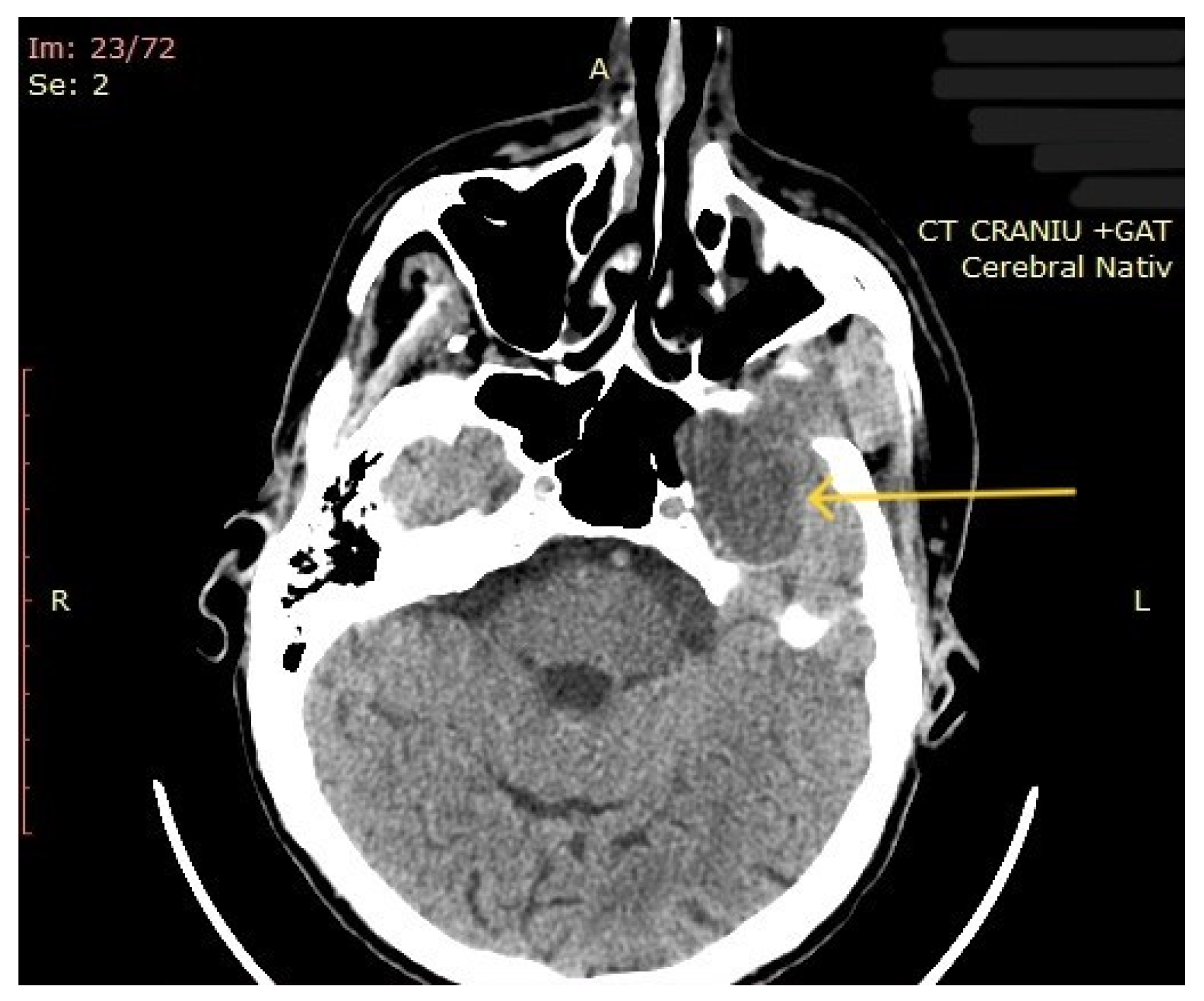 Diagnostics 14 02334 g004