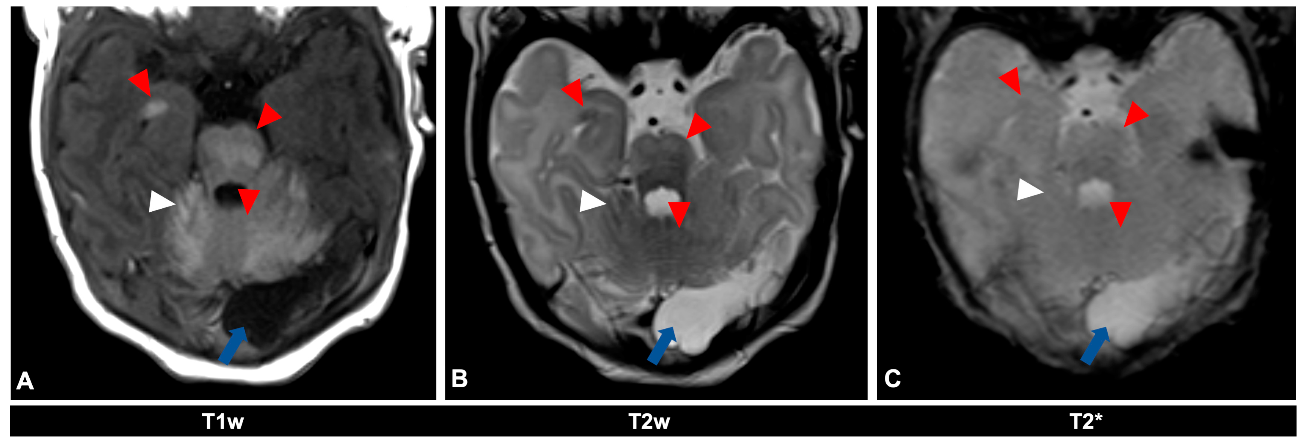 Diagnostics 14 02345 g002