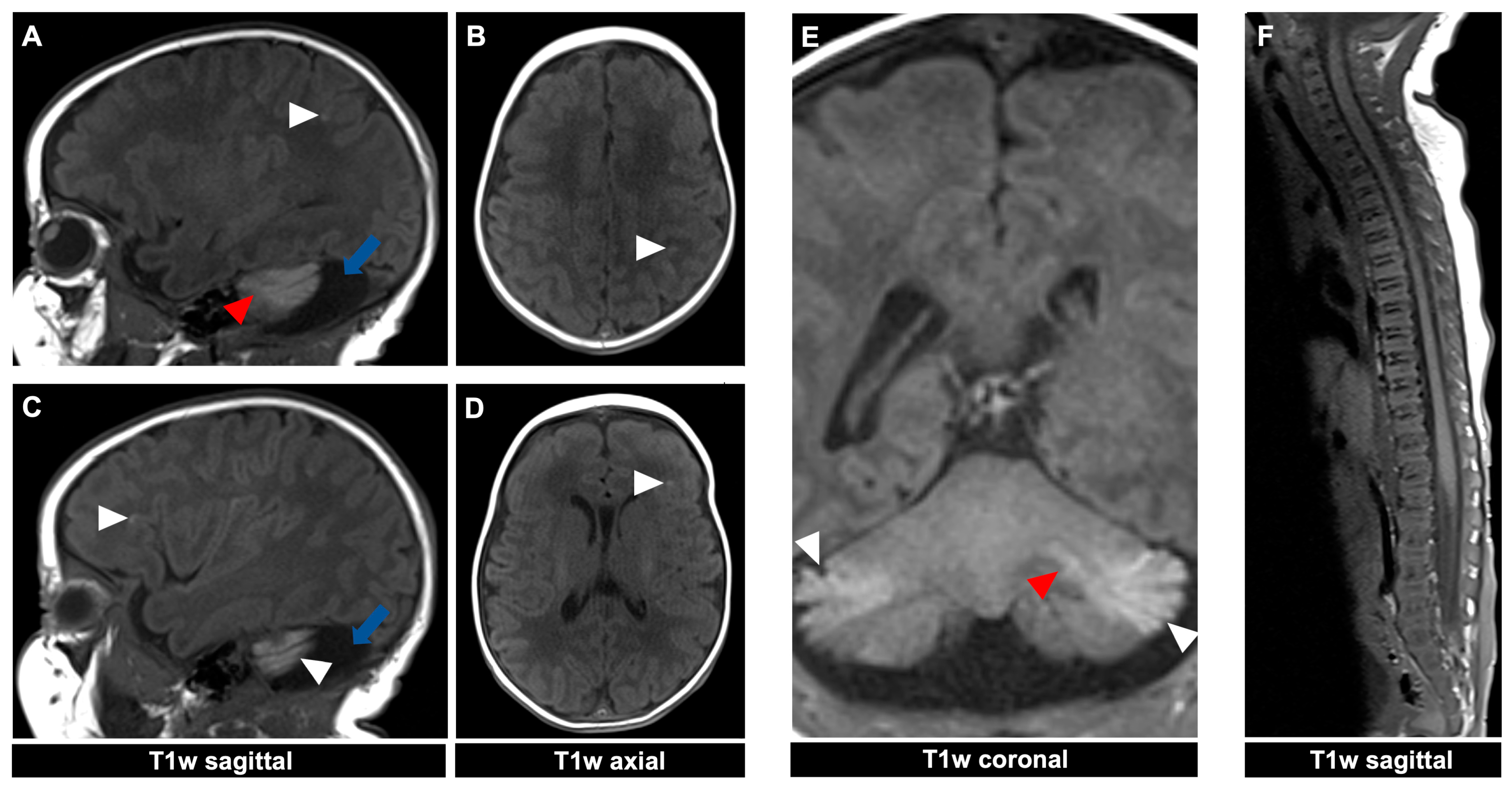 Diagnostics 14 02345 g004