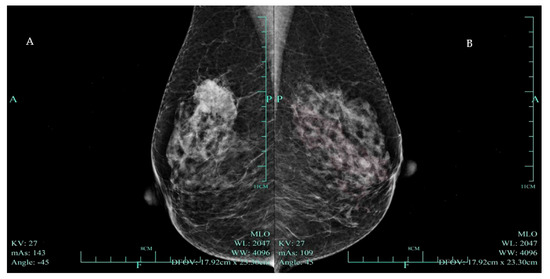 Diagnostics 14 02347 g001