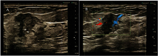 Diagnostics 14 02347 g002