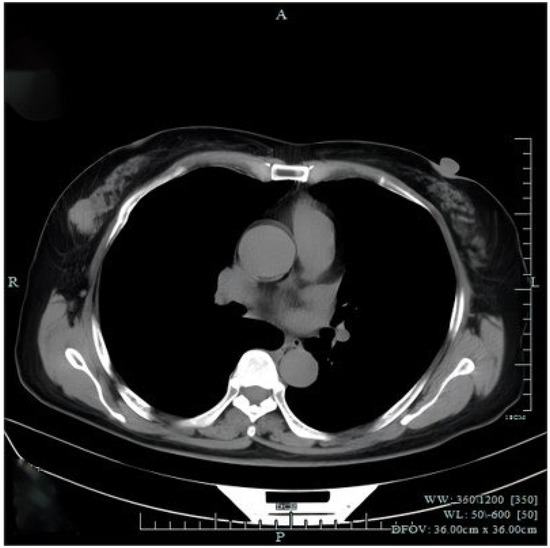 Diagnostics 14 02347 g003