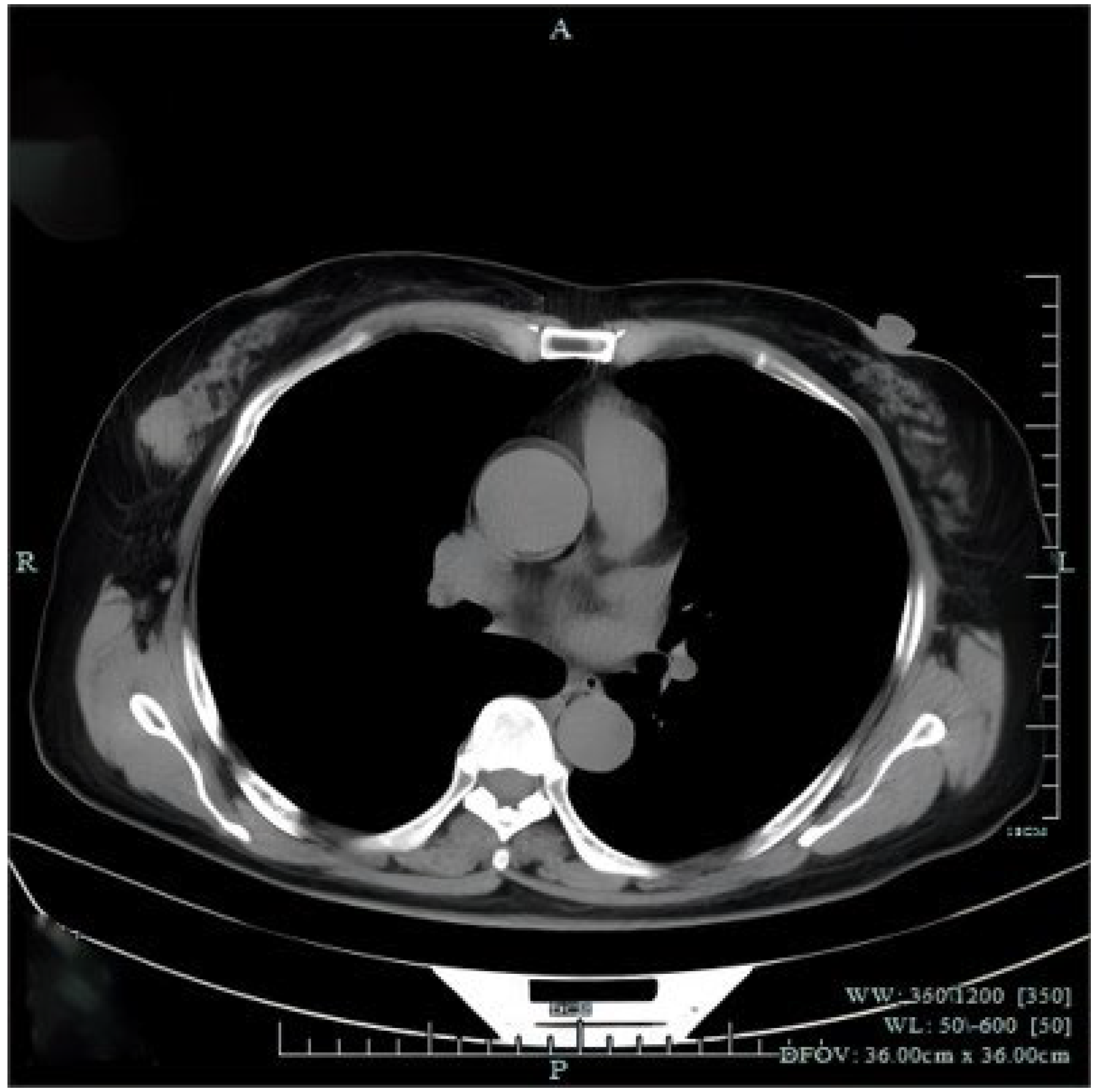 Diagnostics 14 02347 g003