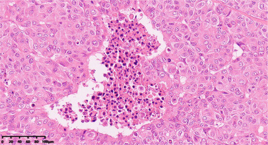 Diagnostics 14 02347 g005