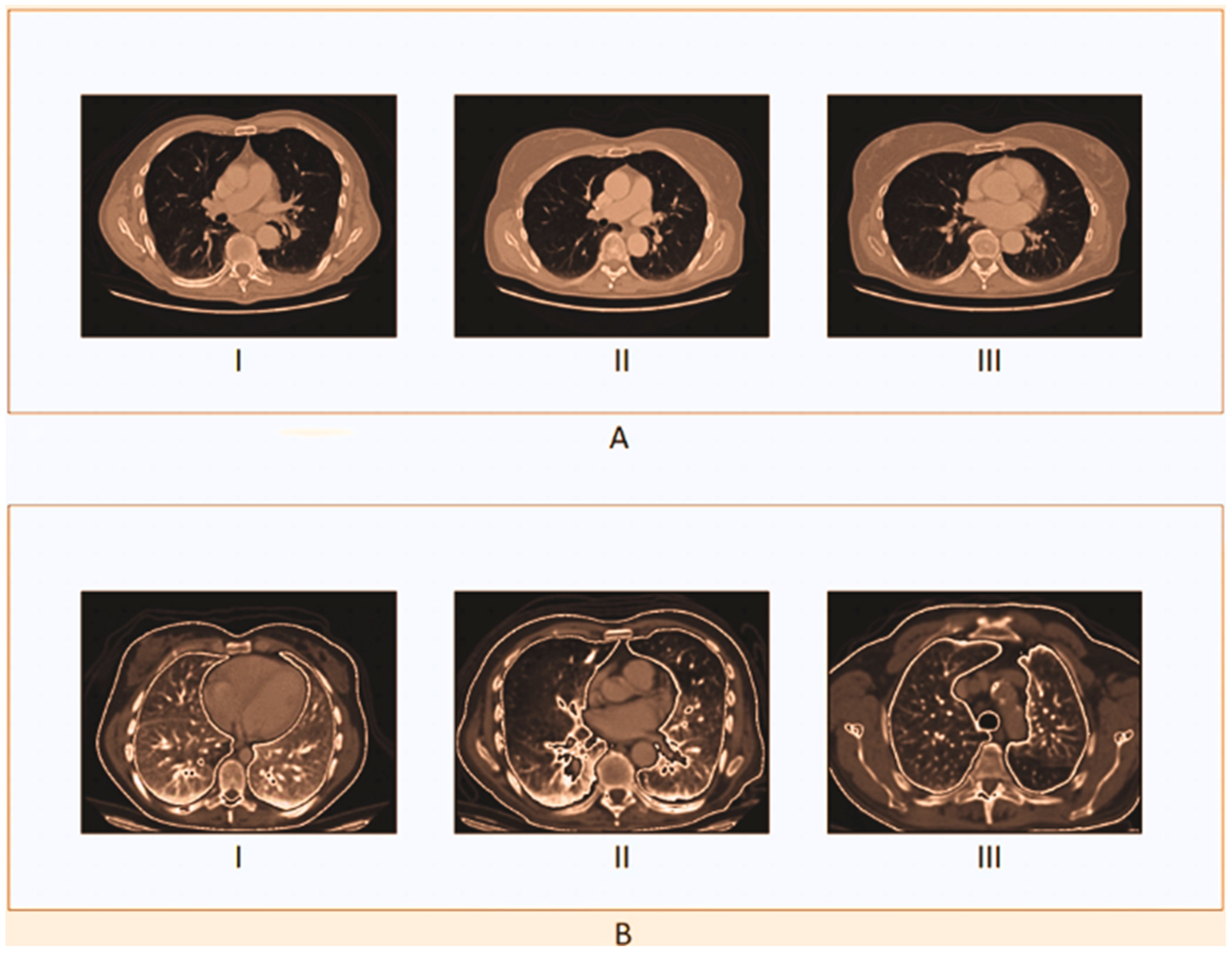 Diagnostics 14 02356 g004a