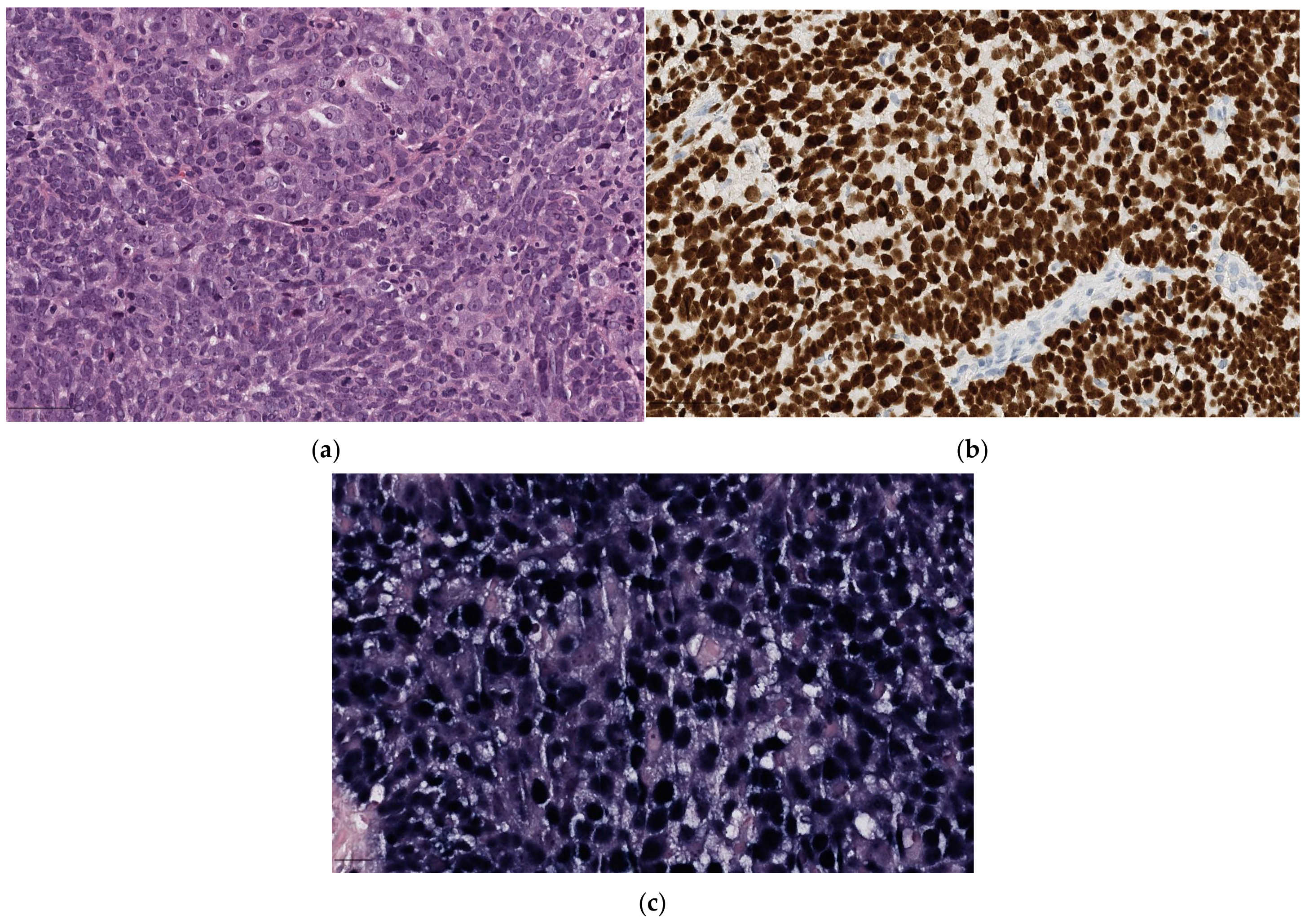 Diagnostics 14 02365 g001