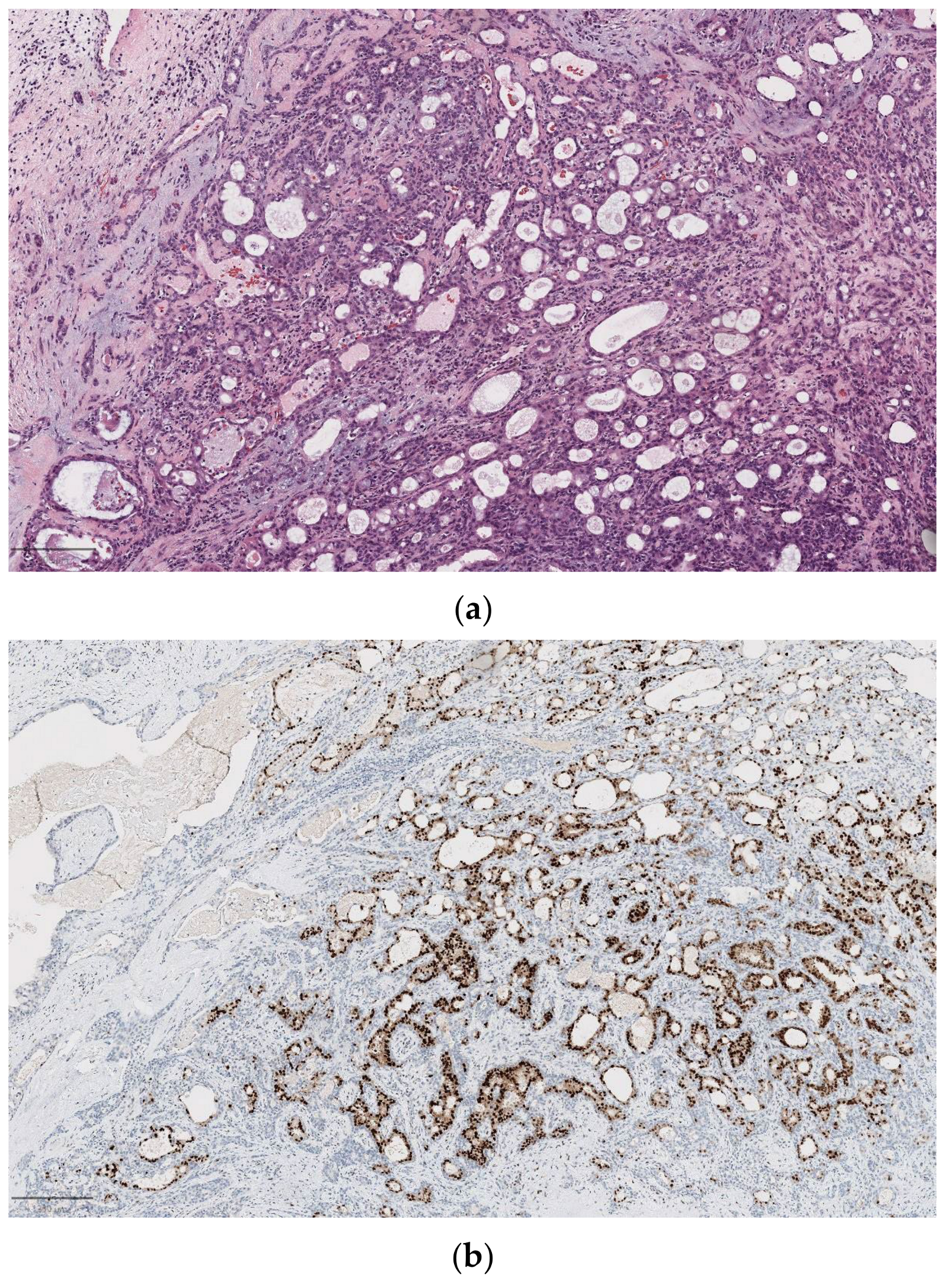 Diagnostics 14 02365 g002a