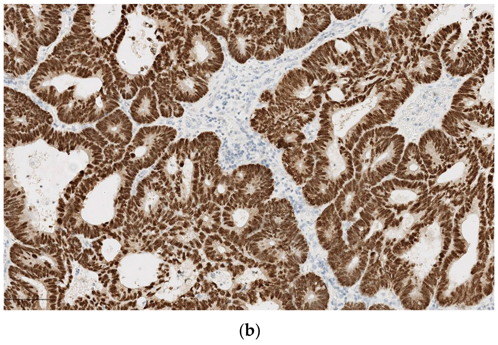 Diagnostics 14 02365 g004b