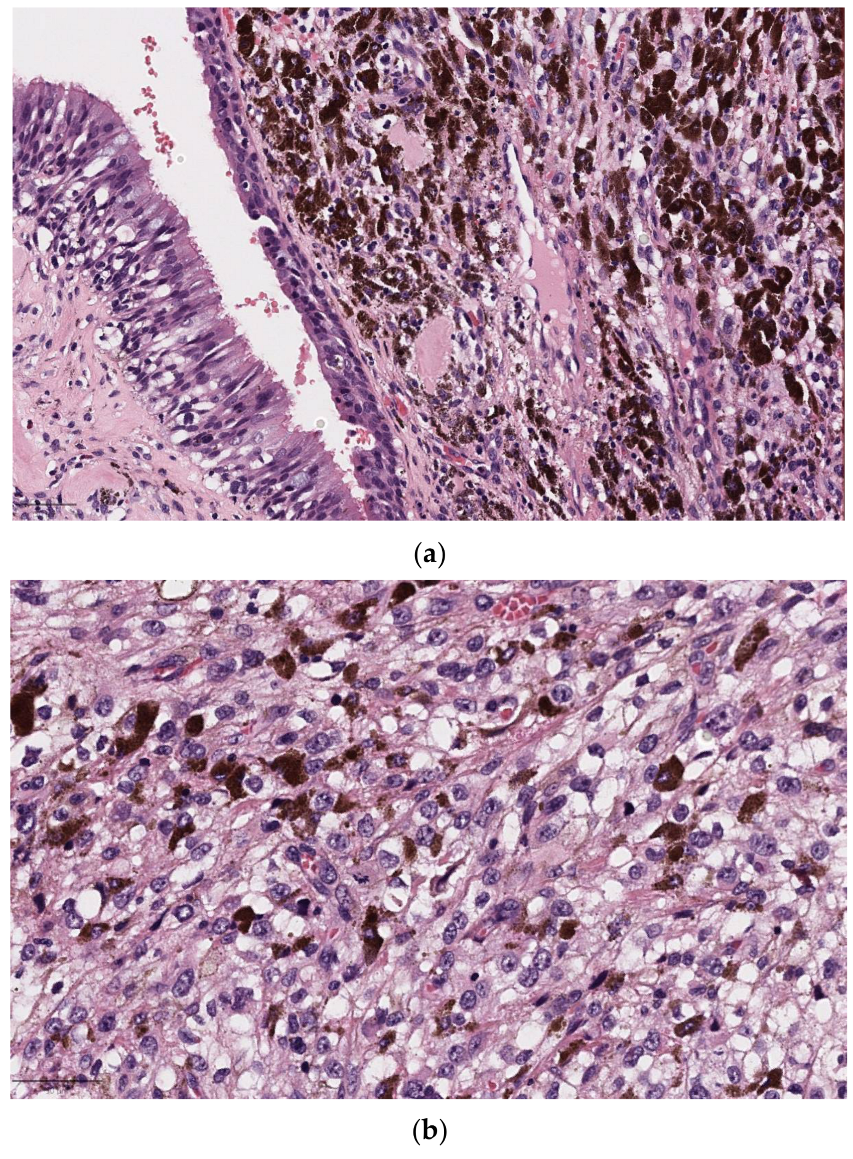 Diagnostics 14 02365 g005
