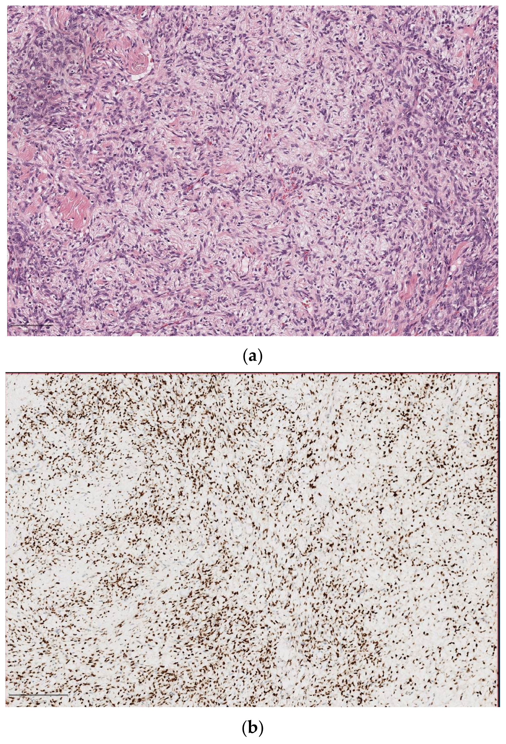 Diagnostics 14 02365 g008